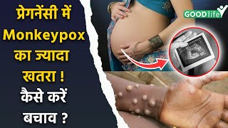 Monkeypox In Pregnancy Symptoms Causes amp Treatment In Hindi [upl. by Marnia]