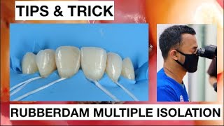 Tips and Trick Isolation With Rubberdam Upper Anterior Without Clamp  General Dentist Griya RR [upl. by Audri480]