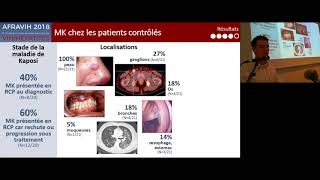 S5  Pathologies opportunistes  Maladie de Kaposi chez des patients vivant avec le VIH et [upl. by Nnylg]