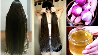 1 Week Challenge  Grow Your Hair Super Faster  After Doing this Your Hair will Never Stop Growing [upl. by Leugimsiul]