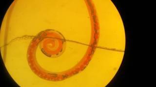 Trichuris trichiura male [upl. by Sacram122]