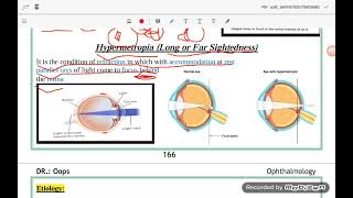 شرح درس Errors of refraction سيميستر 4 [upl. by Notgnirrac]