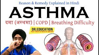 Cure Asthma दमा अस्थमा COPD  Breathing Difficulty  Cough in Hindi DrEDUCATION [upl. by Aicekan]