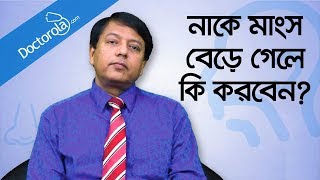 Hypertrophy nasal turbinates  নাকের মাংস বৃদ্ধি  নাকের মাংস বাড়লে করণীয়  Blocked nose relief [upl. by Naenej]