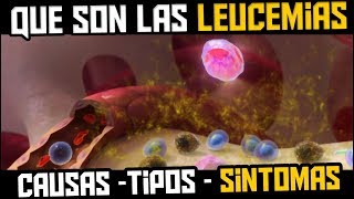 QUE ES LA LEUCEMIA  TIPOS SINTOMAS CAUSAS Y TRATAMIENTO [upl. by Atekan]