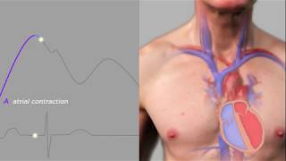 Easy Measurement of Jugular Venous Pressure [upl. by Yenolem]