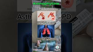 من صالة العمليات امينوفيلين Aminophylline [upl. by Zerdna]