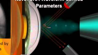 Video ASCRS 2012BiomechanicsIRamosmpeg [upl. by Sioux186]