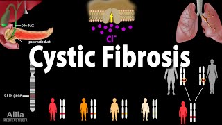 Cystic Fibrosis Pathophysiology Genetics Symptoms Diagnosis and Treatments Animation [upl. by Brittne354]