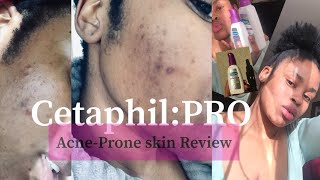 HONEST Cetaphil Gentle Skin Cleanser Review  Cetaphil Gentle Face Wash  skincare cetaphil [upl. by Cirdec]