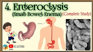 Enteroclysis complete procedure Small Bowel Enema procedure Enteroclysis Complete lecture [upl. by Jared]