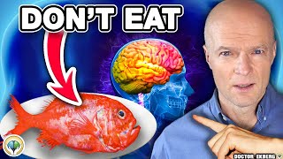 Top 10 Foods That DESTROY Your BRAIN [upl. by Nnil445]