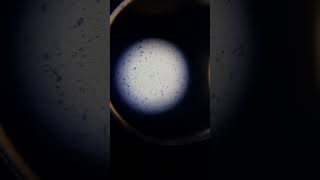 styphi o agglutination under microscope [upl. by Azilem]