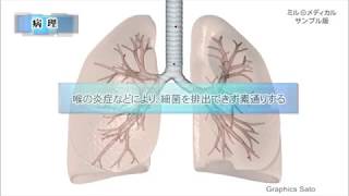 細菌性肺炎／2分で分かる医療動画辞典 ミルメディカル [upl. by Sara841]