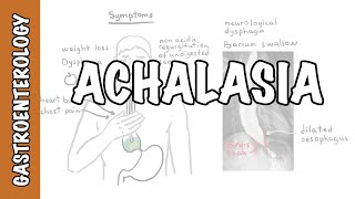 Achalasia esophageal  signs and symptoms pathophysiology investigations and treatment [upl. by Shandy]