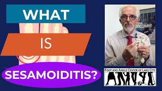 What Is Sesamoiditis [upl. by Maller584]