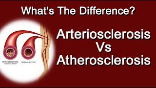 Arteriosclerosis Vs Atherosclerosis  Whats The Difference [upl. by Ortrude]