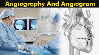 What is Angiography and Angiogram  How Angiography is performed 3D Animation [upl. by Ancelin]