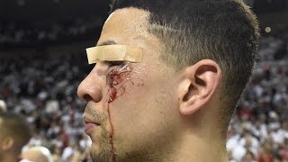 Top 5 Worst Sports Injuries of 2016 [upl. by Marl]