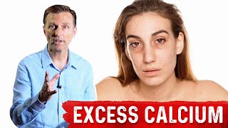 Serious Excess Calcium Side Effects SoftTissue Calcium – DrBerg [upl. by Lahcar]