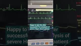 quotJourney to Recovery ICU Monitor Shows Signs of Hope After Severe Heart Attackquot [upl. by Iew]