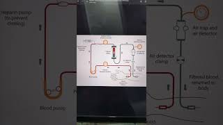 hemodialysis abvmubscnursing bscnursingsyllabus nursingdegree msn sem4 [upl. by Loziram]