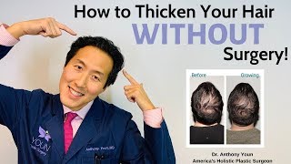 How to Treat Your Thinning Hair Holistically and Thicken it Without Surgery  Dr Anthony Youn [upl. by Nauqat645]