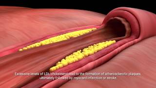 Lactobacillus plantarum INDUCIA [upl. by Annil]