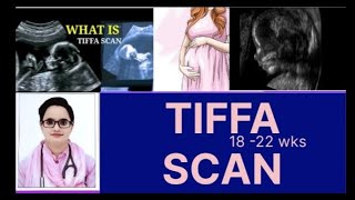 TIFFA SCANanomaly scan5th month scanMost important scanDr Naima Bano [upl. by Pitarys619]