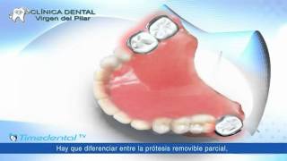 ¿Qué es una prótesis dental removible por Clínica Dental Virgen del Pilar [upl. by Akeem]