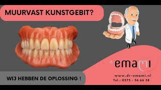 Kunstgebit gehemelte vrije kunstgebit implantaat klickgebit frictie stegprothese [upl. by Okika544]