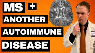 MS  Another Autoimmune Disease Treatment Options [upl. by Reeta184]