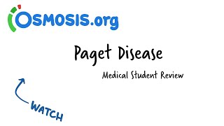 Pagets Disease Of Bone  Pathology [upl. by Durr]