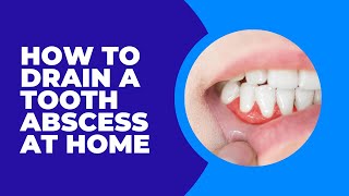 Should you Drain a Tooth Abscess at Home [upl. by Anyl]