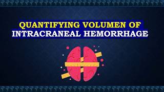 Volume of intracraneal hemorrhage [upl. by Heymann775]