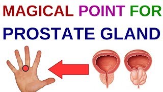 ACUPRESSURE POINTS For PROSTATEProstate ENLARGEMENTProstate ProblemsSUJOK THERAPY For Prostate [upl. by Petty]