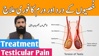 Treatment of Swelling Testicle  Testicular Pain Treatment  Testicle Pain Relief in Urdu [upl. by Yelra]