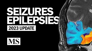 Seizures and Epilepsies 2023 [upl. by Adiana]