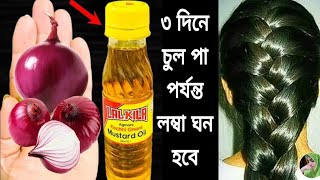 ৩ দিন এটা লাগাও চুল পড়া বন্ধ হবে চুল ঘন লম্বা কালো হবে নতুন চুল গজাবেhair growth remedies [upl. by Thetisa]