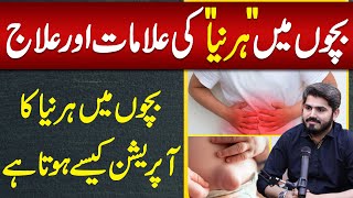 Hernia Symptoms amp Causes of Hernia in Babies  Hernia Treatment amp Hernia Surgery in Babies [upl. by Demb]