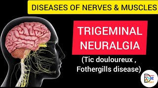 TRIGEMINAL NEURALGIA FOTHERGILLS DISEASE TIC DOULOUREUX [upl. by Omrellug]