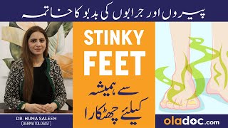 STINKY FEET  Paon Ki Smell Se Nijat  SMELLY FEET Solution  Pairon Se Badbu Khatam Karne Ka Tarika [upl. by Rab]