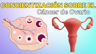 Concientización sobre el cáncer de ovario causas diagnóstico y tratamiento oncológico ginecológico [upl. by Noyes]