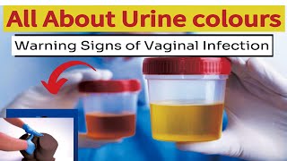 Urine Colour Danger sign of Vaginal InfectionUTIUrinary Tract Infections symptoms [upl. by Rehpotsyrhc]