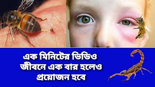 Honey Bee Bite Treatment  Honey Bee Bite Home Remedies  Bolta Moumachi Kamor Dile Koronio Bangla [upl. by Attebasile]