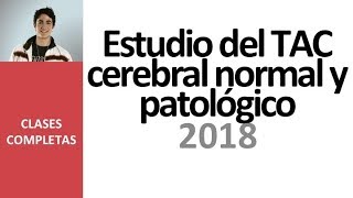 Estudio del TAC cerebral normal y patológico  Videoclase completa 2018 [upl. by Llenrep15]