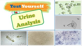 Review 📝  Microscopical 🔬 Examination of Urine 🚽 [upl. by Norha]