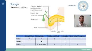 CHIRURGIA Ittero ostruttivo [upl. by Baram]