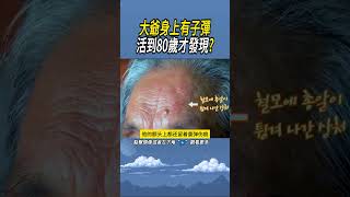 大爺身上有子彈，活到80歲才發現 實驗 科普 [upl. by Melosa]