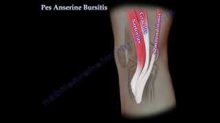 Pes Anserine Bursitis  knee pain  Everything You Need To Know  Dr Nabil Ebraheim [upl. by Ettenrahs]